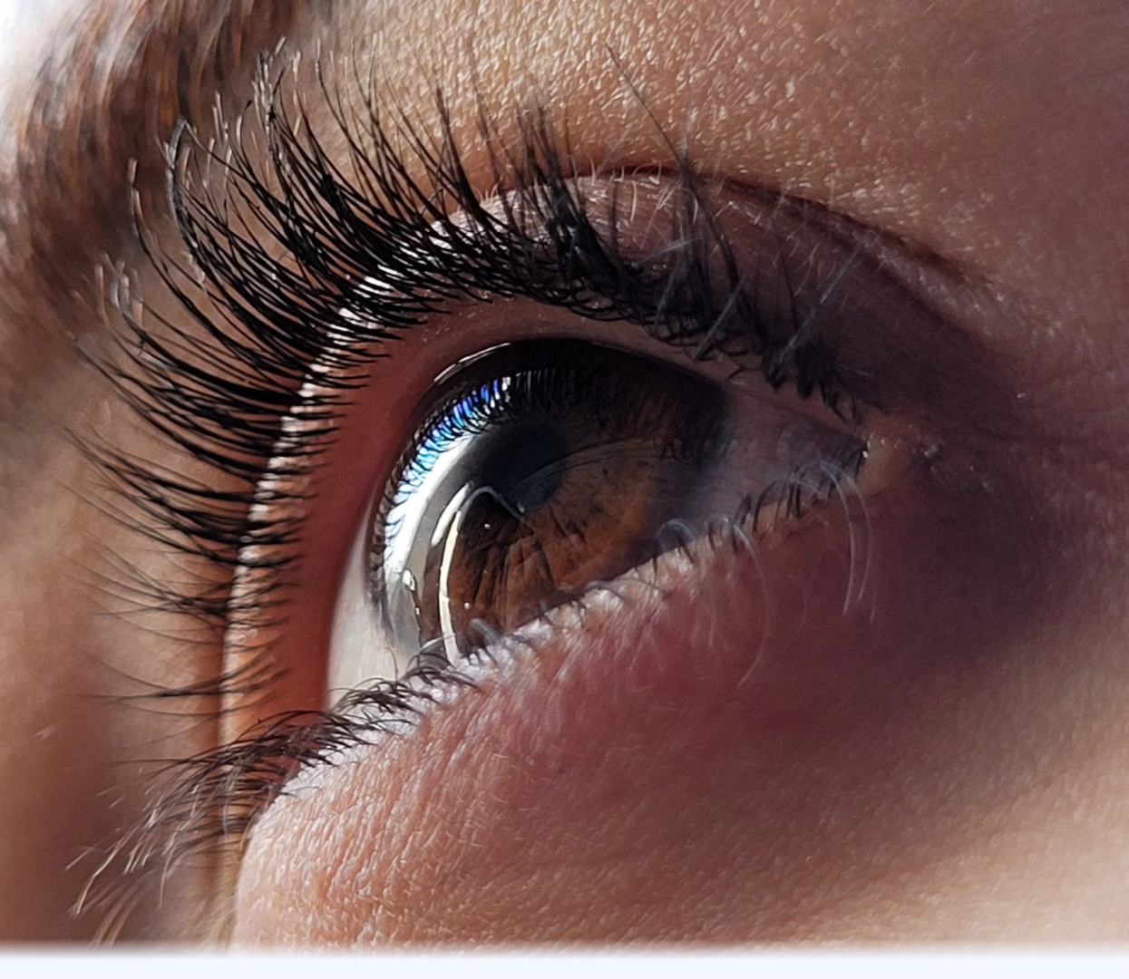 Oftalmología General - Centro Oftalmológico Dr. Andersson Recoleta CABA